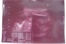 Pek - 26 mei 2011!
